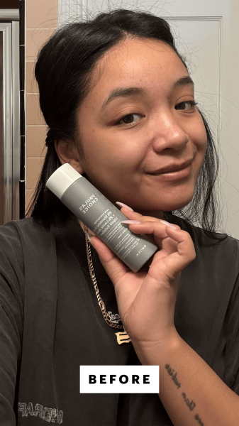 Richards before applying the Paula's Choice 6 Mandelic Acid 2 Lactic Acid AHA Liquid Exfoliant